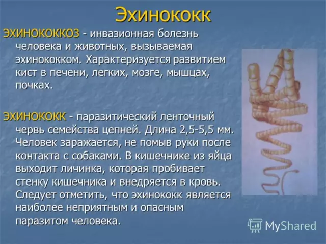 Что делать в случае подозрения на заражение эхинококком