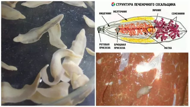 Исследования и новые методики лечения печеночного сосальщика