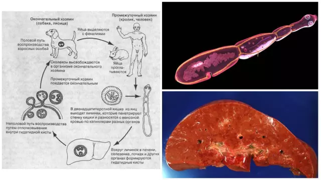 Какой происхождение паразита эхинококк и как он попадает в организм человека