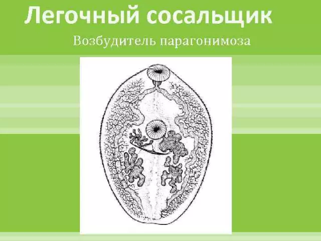 Легочный сосальщик у взрослых: особенности диагностики и лечения