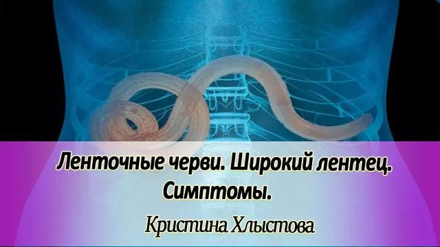 Лентец широкий: польза и вред для здоровья