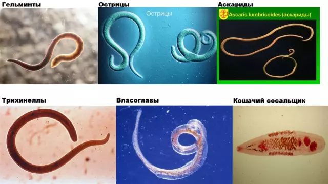 Самые распространенные способы заражения лямблиями