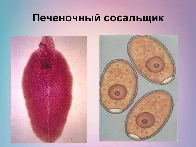 Симптомы и диагностика печеночного сосальщика: когда обратиться к врачу